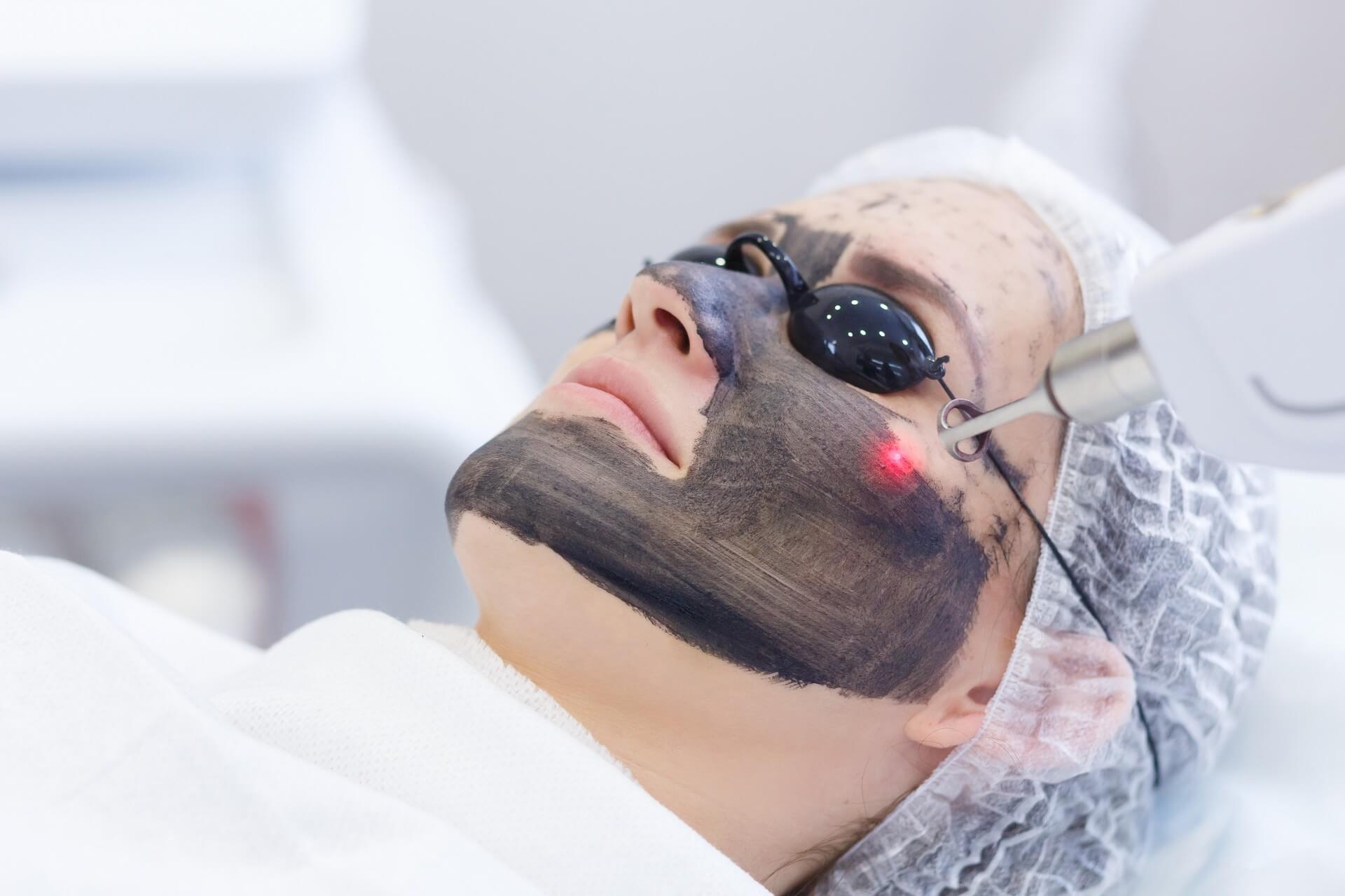 3D Laser Facial