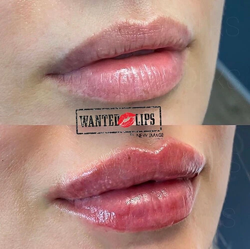 New Image Works - Wanted Lips