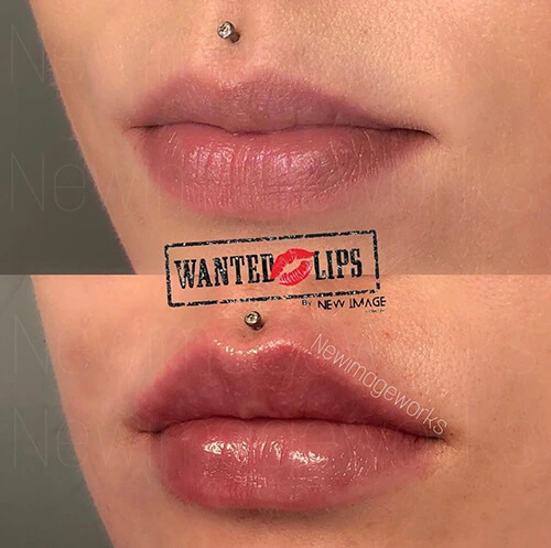 New Image Works - Wanted Lips