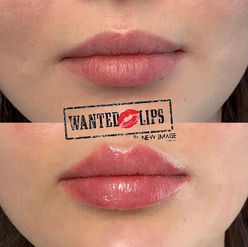 New Image Works - Wanted Lips