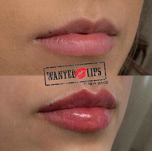 New Image Works - Wanted Lips