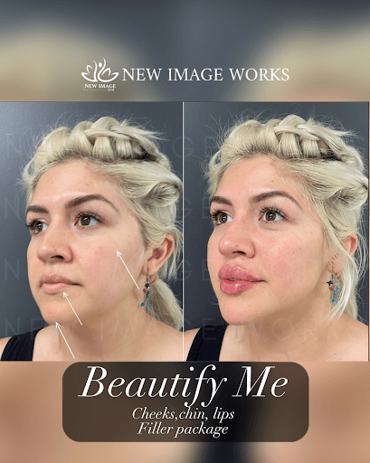 New Image Works - Beautify Me