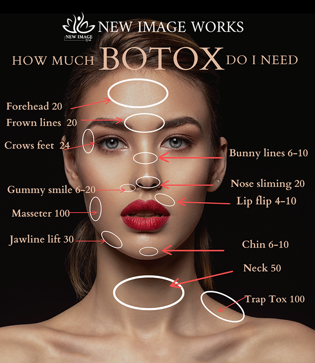 How Much Botox Do I need