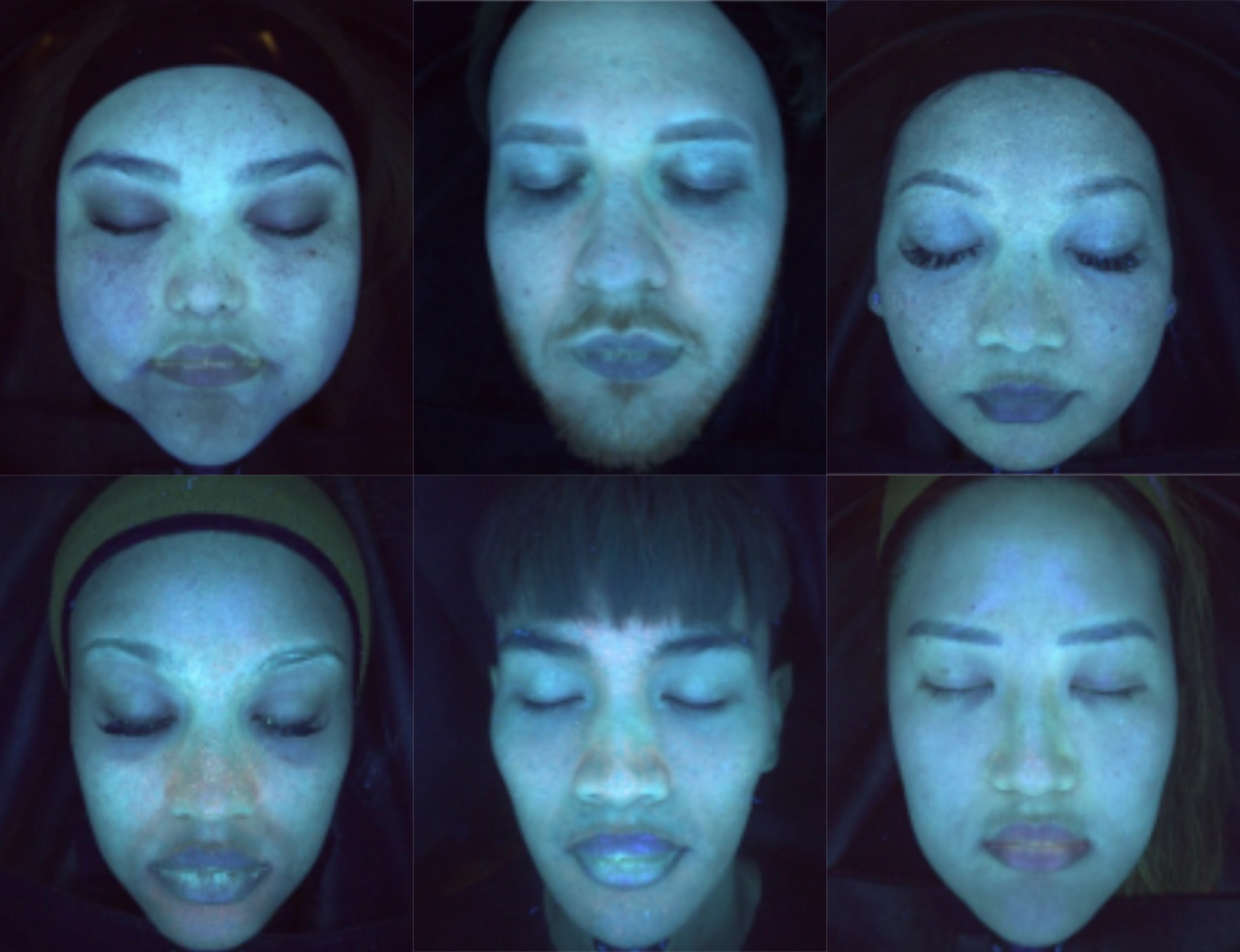 UV light reveals hidden sun damage, hyperpigmentation, and deep skin discoloration not visible on the surface.