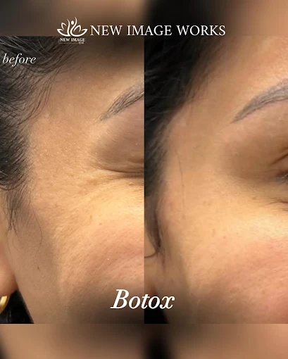 Botox before and after results at New Image Works Glenview