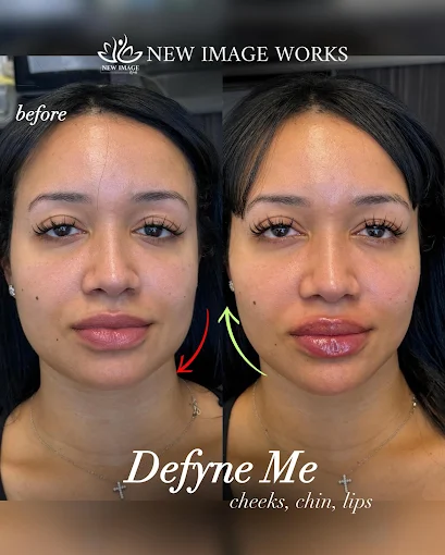Defyne treatment before and after results in Glenview