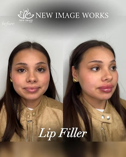 Lip enhancement before and after at New Image Works Glenview